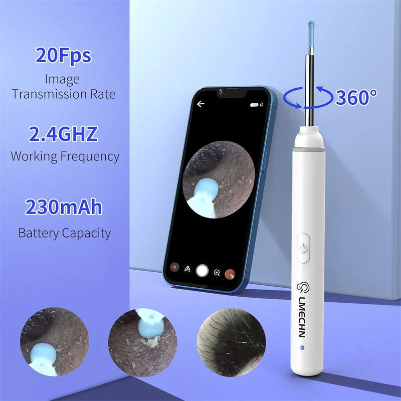 Ear Wax Removal Tool with 1920P HD Camera