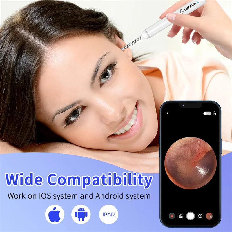 Ear Wax Removal Tool with 1920P HD Camera