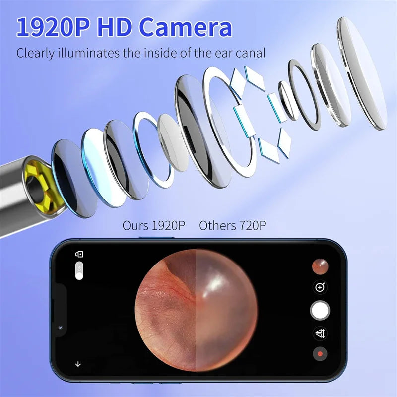 Ear Wax Removal Tool with 1920P HD Camera