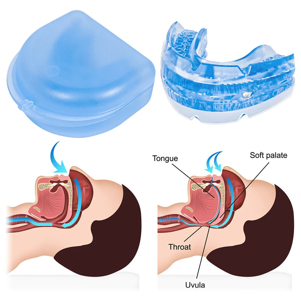 Anti Snoring Mouth Guard